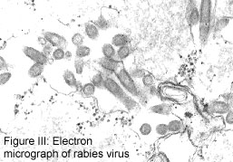 electron micrograph of rabies virus