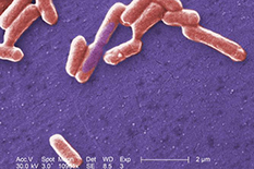 Image of E. coli bacteria