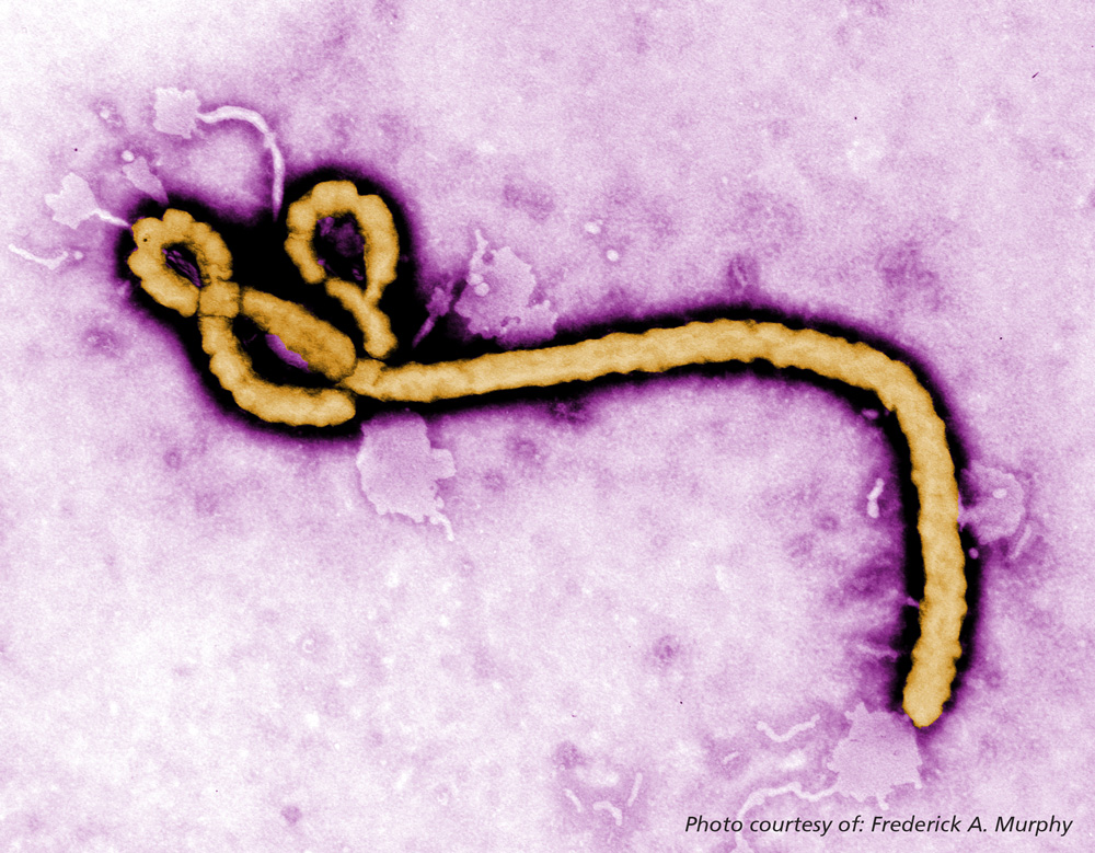 Photograph of Ebola virus.